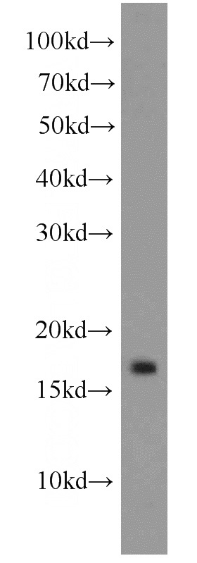rat brain tissue were subjected to SDS PAGE followed by western blot with Catalog No:110800(ATG8L antibody) at dilution of 1:1000