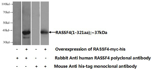 Transfected HEK-293 cells were subjected to SDS PAGE followed by western blot with Catalog No:114482(RASSF4 Antibody) at dilution of 1:1000