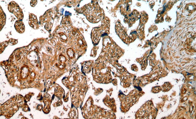 Immunohistochemical of paraffin-embedded human placenta using Catalog No:111116(GPR161 antibody) at dilution of 1:50 (under 10x lens)