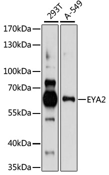 Western blot - EYA2 Polyclonal Antibody 