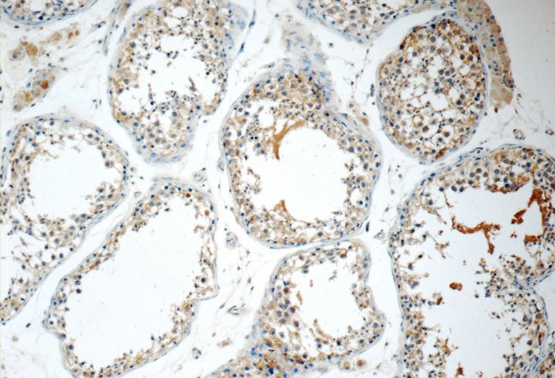 Immunohistochemistry of paraffin-embedded human testis tissue slide using Catalog No:113327(ODF3 Antibody) at dilution of 1:50 (under 10x lens)