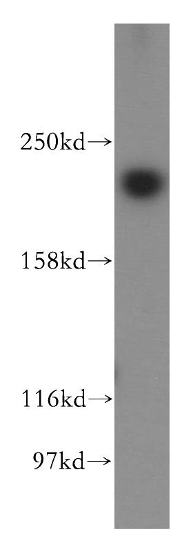 HeLa cells were subjected to SDS PAGE followed by western blot with Catalog No:113368(NUMA1 antibody) at dilution of 1:300