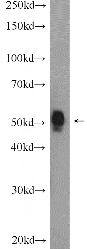 mouse lung tissue were subjected to SDS PAGE followed by western blot with Catalog No:110564(FBXW4 Antibody) at dilution of 1:300