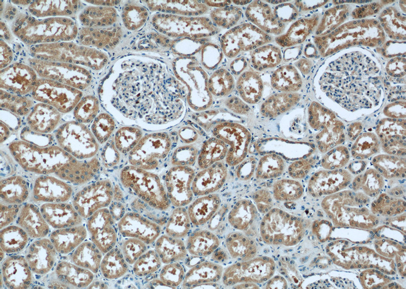 Immunohistochemistry of paraffin-embedded human kidney tissue slide using Catalog No:113573(PANX1 Antibody) at dilution of 1:50 (under 10x lens)