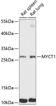 Western blot - MYCT1 Polyclonal Antibody 