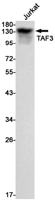 Western blot detection of TAF3 in Jurkat cell lysates using TAF3 Rabbit mAb(1:1000 diluted).Predicted band size:104kDa.Observed band size:140kDa.