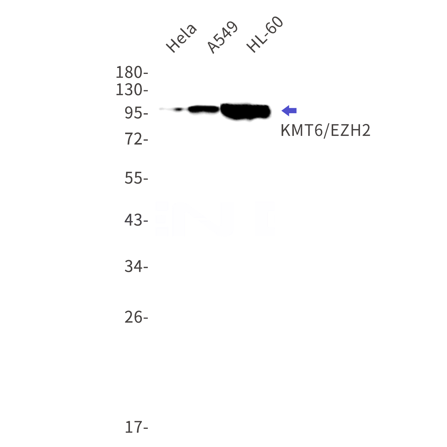 Western blot detection of KMT6/EZH2 in Hela,A549,HL-60 cell lysates using KMT6/EZH2 Rabbit mAb(1:1000 diluted).Predicted band size:85kDa.Observed band size:98kDa.