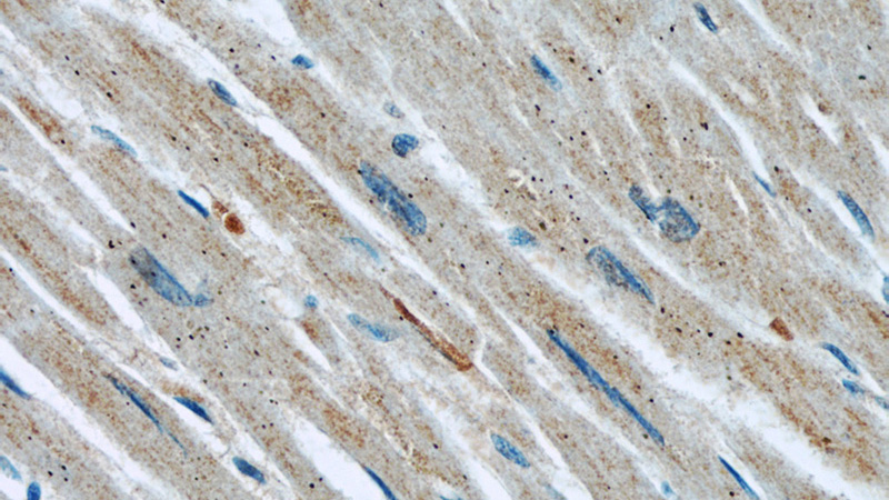 Immunohistochemical of paraffin-embedded human heart using Catalog No:113875(PIK3R6 antibody) at dilution of 1:50 (under 40x lens)