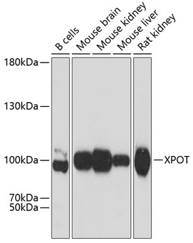 Western blot - XPOT Polyclonal Antibody 