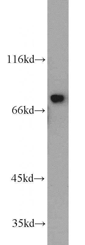 HeLa cells were subjected to SDS PAGE followed by western blot with Catalog No:110102(DNAJC10 antibody) at dilution of 1:1500