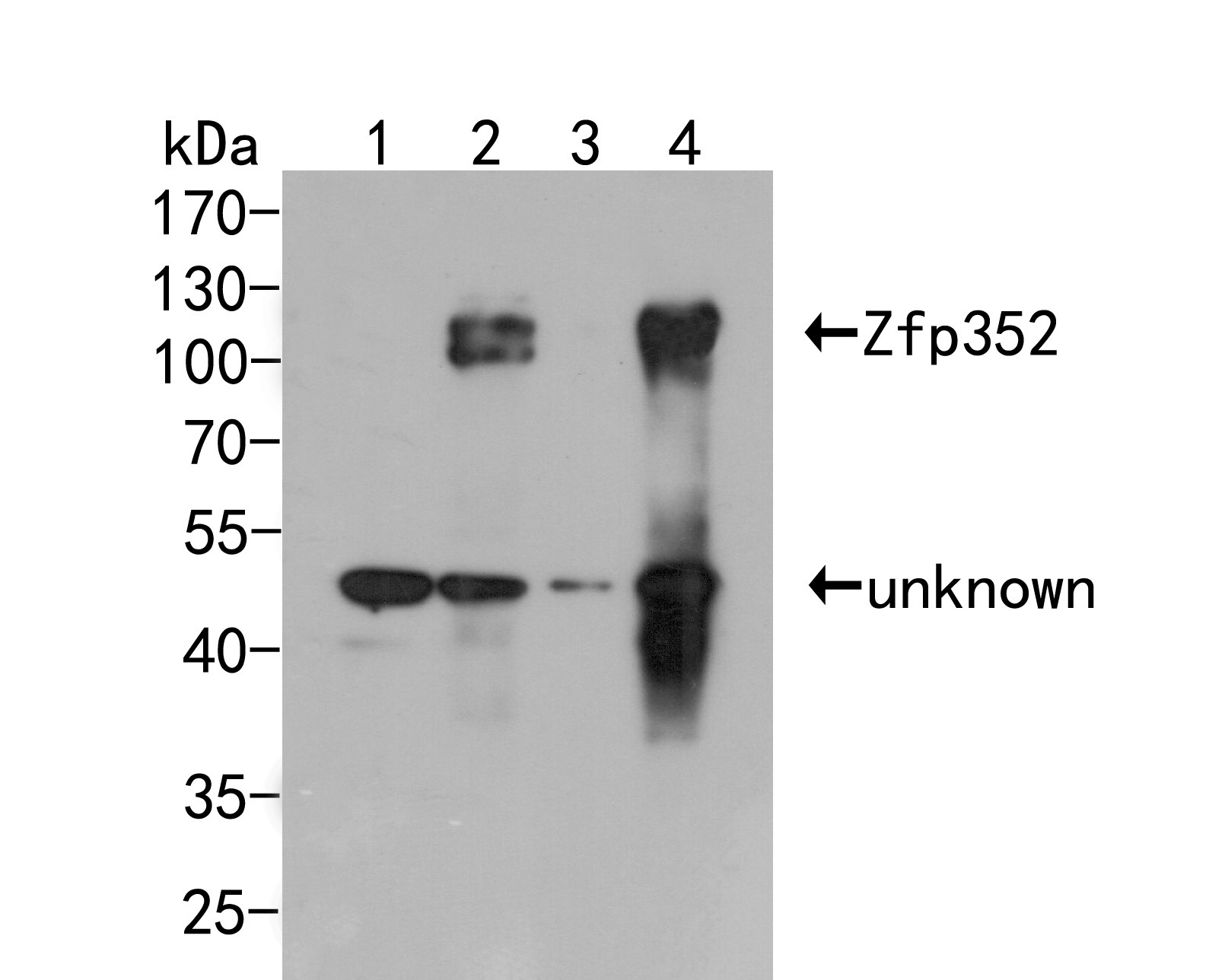 Fig1:; Western blot analysis of Zfp352 on different lysates. Proteins were transferred to a PVDF membrane and blocked with 5% BSA in PBS for 1 hour at room temperature. The primary antibody ( 1/1000) was used in 5% BSA at room temperature for 2 hours. Goat Anti-Rabbit IgG - HRP Secondary Antibody (HA1001) at 1:5,000 dilution was used for 1 hour at room temperature.; Positive control:; Lane 1: Non-transfected 293T cells lysate; Lane 2: GFP-tagged Zfp352 transfected 293T cells lysate; Lane 3: Non-transfected 293F cells lysate; Lane 4: GFP-tagged Zfp352 transfected 293F cells lysate