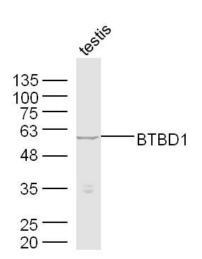 Fig2: Sample: Testis (Mouse) Lysate at 40 ug; Primary: Anti-BTBD1 at 1/300 dilution; Secondary: IRDye800CW Goat Anti-Rabbit IgG at 1/20000 dilution; Predicted band size: 53 kD; Observed band size: 53 kD