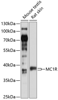 Western blot - MC1R Polyclonal Antibody 