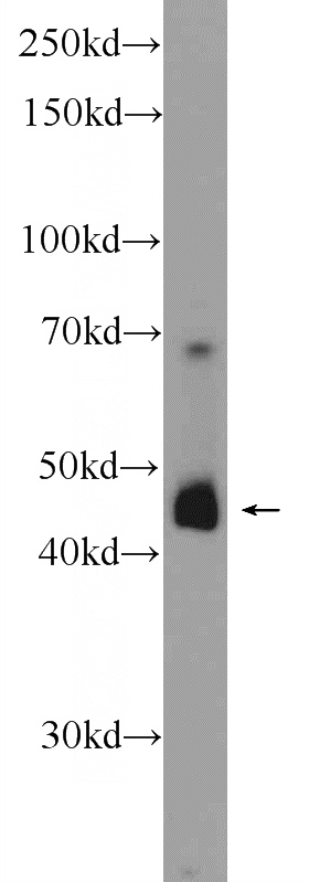 human testis tissue were subjected to SDS PAGE followed by western blot with Catalog No:115547(SPATA1 Antibody) at dilution of 1:300