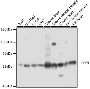 Western blot - PDP1 Polyclonal Antibody 
