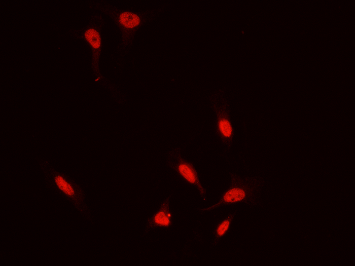 ZIC3 Antibody, Rabbit PAb, Antigen Affinity Purified, Immunofluorescence