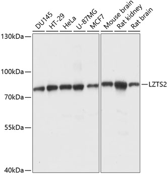 Western blot - LZTS2 Polyclonal Antibody 