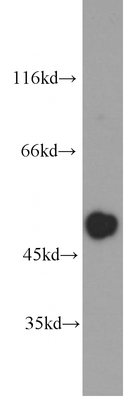 Jurkat cells were subjected to SDS PAGE followed by western blot with Catalog No:107188(CXCR7 antibody) at dilution of 1:1000
