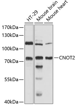 Western blot - CNOT2 Polyclonal Antibody 