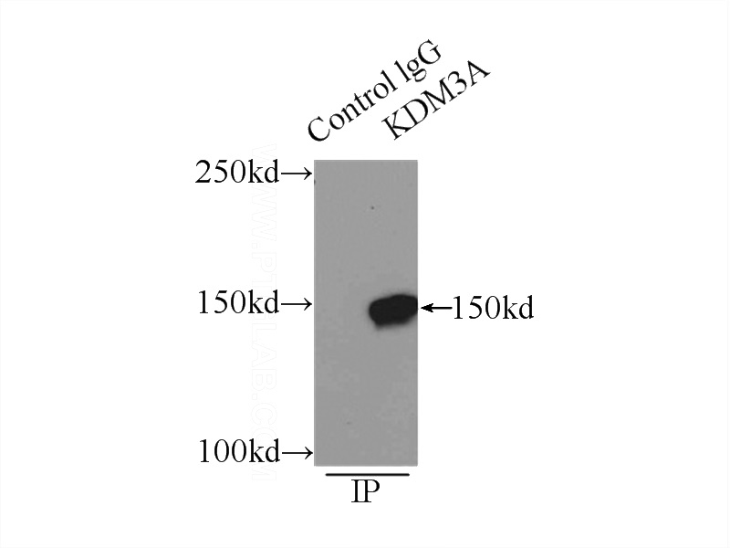 IP Result of anti-KDM3A,JMJD1A (IP:Catalog No:112025, 5ug; Detection:Catalog No:112025 1:1000) with HeLa cells lysate 2500ug.