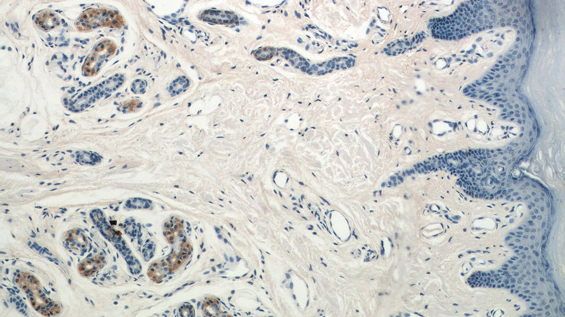 Immunohistochemical of paraffin-embedded human skin using Catalog No:110928(GDI2 antibody) at dilution of 1:50 (under 10x lens)
