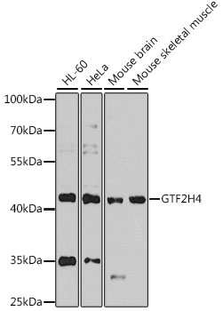 Western blot - GTF2H4 Polyclonal Antibody 