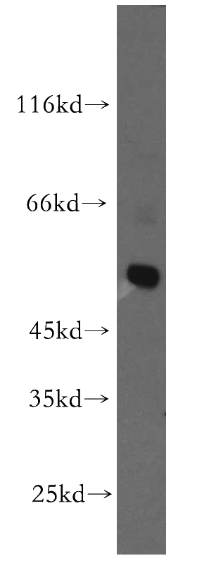 MCF7 cells were subjected to SDS PAGE followed by western blot with Catalog No:111032(GLRA3 antibody) at dilution of 1:200