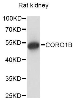 Western blot - CORO1B Polyclonal Antibody 