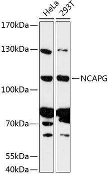 Western blot - NCAPG Polyclonal Antibody 