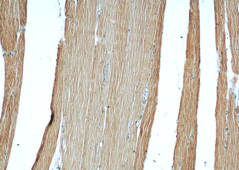 Immunohistochemical of paraffin-embedded human skeletal muscle using Catalog No:108343(ATP1A2 antibody) at dilution of 1:50 (under 10x lens)