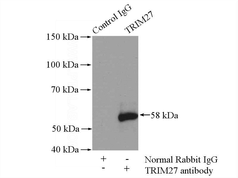 IP Result of anti-TRIM27 (IP:Catalog No:116308, 4ug; Detection:Catalog No:116308 1:1000) with mouse testis tissue lysate 4000ug.