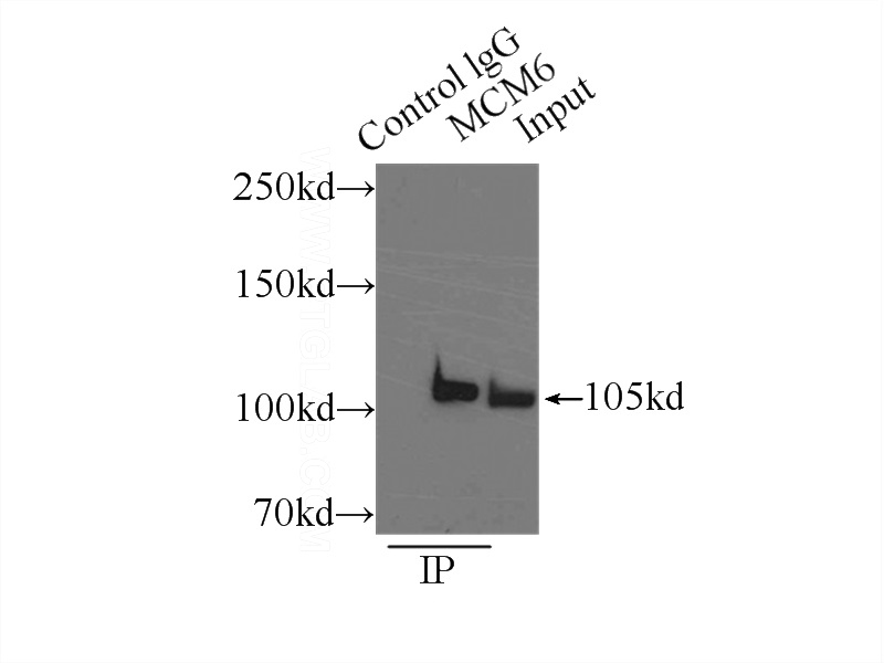 IP Result of anti-MCM6 (IP:Catalog No:112556, 3ug; Detection:Catalog No:112556 1:1000) with HeLa cells lysate 3800ug.