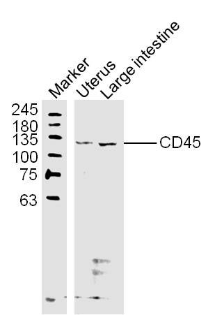 Fig2: Sample:; Uterus (Mouse) Lysate at 40 ug; Large intestine (Mouse) Lysate at 40 ug; Primary: Anti-CD45 at 1/300 dilution; Secondary: IRDye800CW Goat Anti-Rabbit IgG at 1/20000 dilution; Predicted band size: 137 kD; Observed band size: 130 kD
