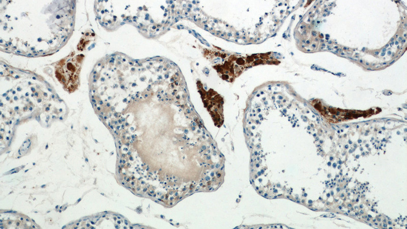 Immunohistochemistry of paraffin-embedded human testis tissue slide using Catalog No:116620(UNG Antibody) at dilution of 1:50 (under 10x lens)