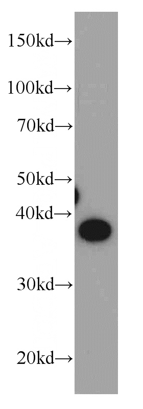L02 cells were subjected to SDS PAGE followed by western blot with Catalog No:111447(HPDL antibody) at dilution of 1:500