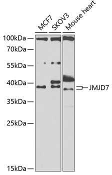 Western blot - JMJD7 Polyclonal Antibody 