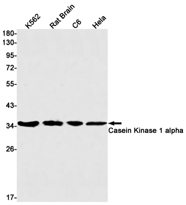 Western blot detection of Casein Kinase 1 alpha in K562,Rat Brain,C6,Hela cell lysates using Casein Kinase 1 alpha Rabbit mAb(1:1000 diluted).Predicted band size:39kDa.Observed band size:34kDa.