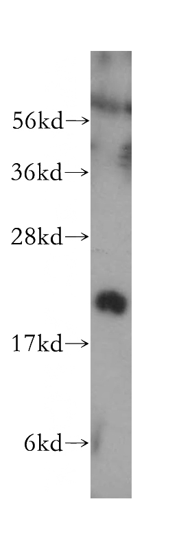 mouse pancreas tissue were subjected to SDS PAGE followed by western blot with Catalog No:109356(CNPY2,MSAP antibody) at dilution of 1:300