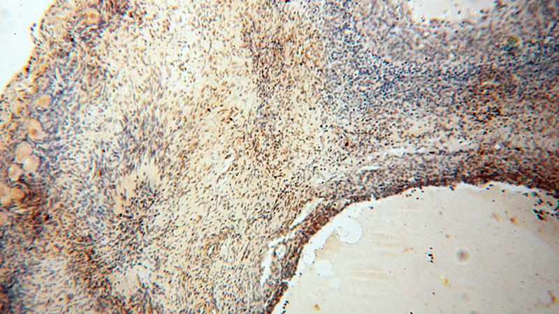 Immunohistochemical of paraffin-embedded human ovary using Catalog No:111356(HIRIP3 antibody) at dilution of 1:50 (under 10x lens)