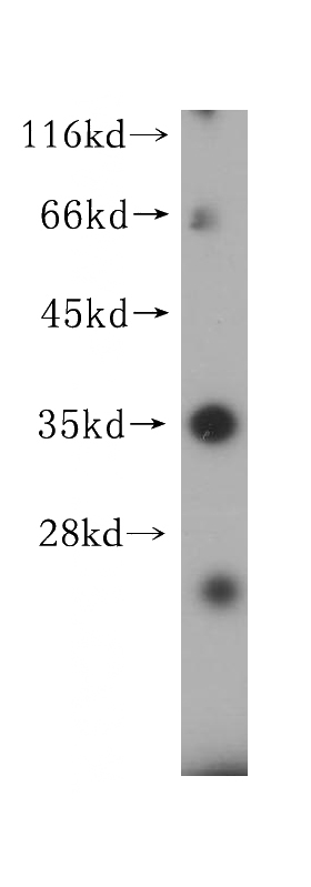 Jurkat cells were subjected to SDS PAGE followed by western blot with Catalog No:111427(HLA-DRB4 antibody) at dilution of 1:600