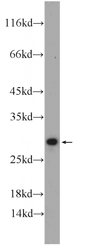 mouse heart tissue were subjected to SDS PAGE followed by western blot with Catalog No:108990(CCDC85B Antibody) at dilution of 1:300