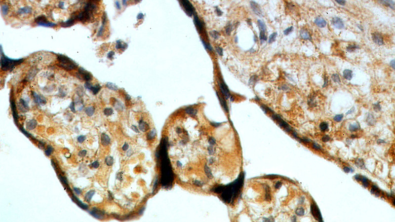 Immunohistochemical of paraffin-embedded human placenta using Catalog No:110372(TXNDC12 antibody) at dilution of 1:50 (under 40x lens)