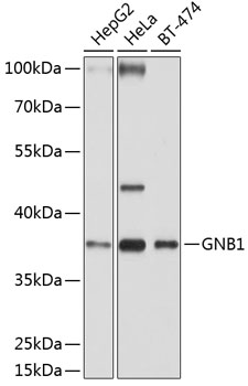 Western blot - GNB1 Polyclonal Antibody 