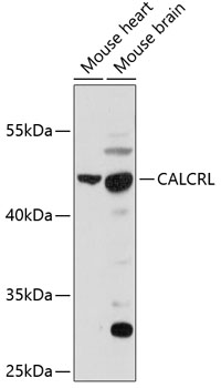 Western blot - CALCRL Polyclonal Antibody 