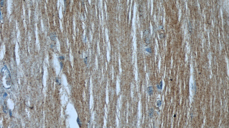 Immunohistochemical of paraffin-embedded human skeletal muscle using Catalog No:115786(SYNM antibody) at dilution of 1:50 (under 40x lens)