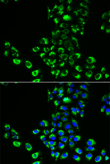 Immunofluorescence - EIF5B Polyclonal Antibody 