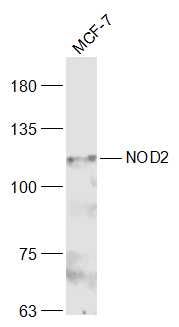 Fig1: Sample:; MCF-7(Human) Cell Lysate at 30 ug; Primary: Anti-NOD2 at 1/300 dilution; Secondary: IRDye800CW Goat Anti-Rabbit IgG at 1/20000 dilution; Predicted band size: 114 kD; Observed band size: 114 kD