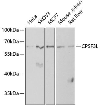 Western blot - CPSF3L Polyclonal Antibody 