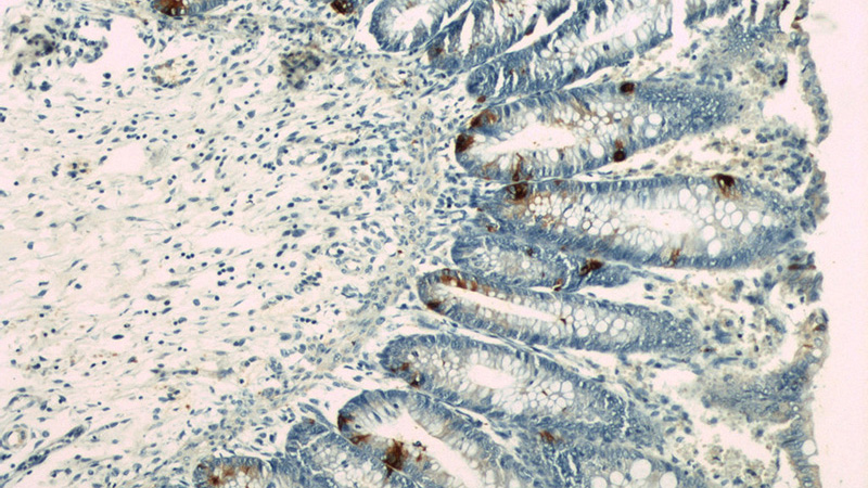 Immunohistochemical of paraffin-embedded human colon using Catalog No:109287(CHGA antibody) at dilution of 1:50 (under 10x lens)