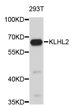 Western blot - KLHL2 Polyclonal Antibody 